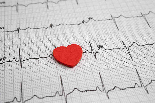 istock Electrocardiogram ECG heart wave, heart attack, cardiogram report. 2229405274