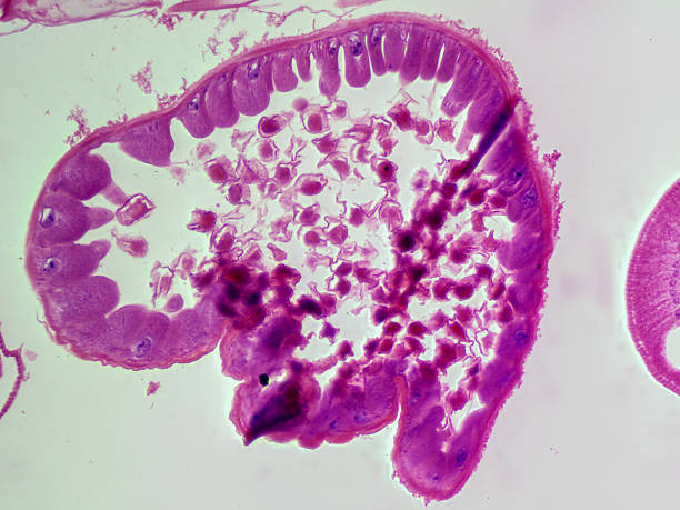 istock Histology Microscope Image of Female Ascaris Roundworm Uterus with Eggs Cross Section (100x) 2229434491