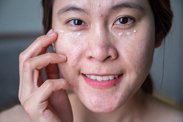 istock Asian woman smiling while applying anti aging cream on her under eyes. 2229472573