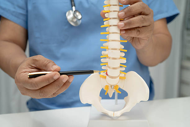 istock Asian doctor holding spinal nerve and bone model, Lumbar spine displaced herniated disc fragment for treatment medical in the orthopedic department. 2229869759