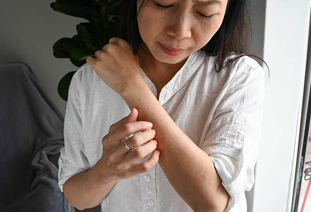 istock Female with Skin Problem: Rash on Thigh Area 2229905722