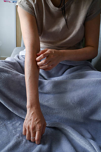 Inflamed Skin: Woman Scratches Thigh Rash
