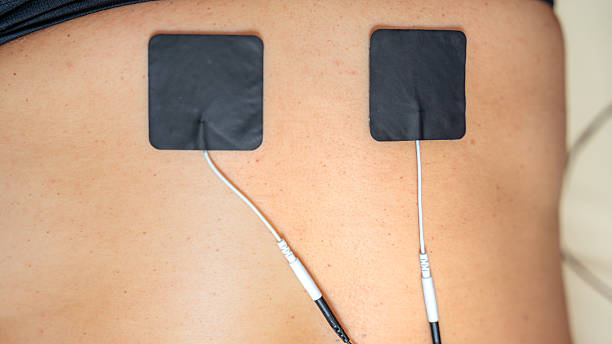 istock Patient receiving electrical muscle stimulation therapy on back 2230008281
