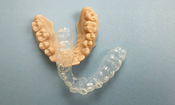 istock Dental impression and worn pediatric mouthguard set against a blue background, showing usage marks and orthodontic details 2230239235