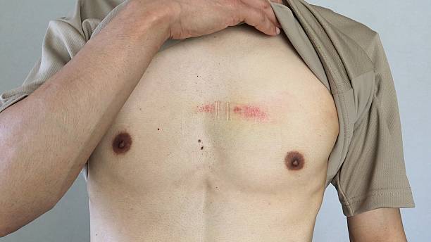 istock Naked man with injuries 2230377416