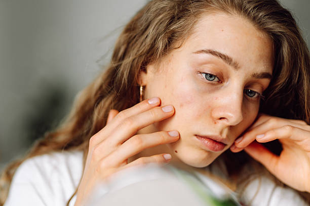 istock Curly woman examines her skin and touches it with hands while looking into small mirror. 2230577145