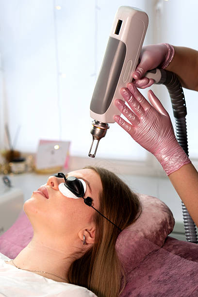 istock Technician positions laser above closed eyes for eyebrow tattoo removal 2230911314