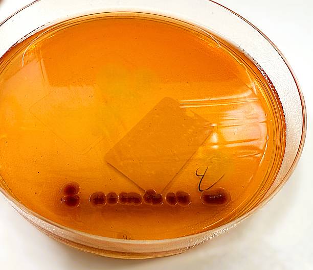 Close-up image of Vibrio cholerae bacterial colonies grown on agar plate in microbiology laboratory. The pathogenic microorganism responsible for cholera is shown in detailed culture, useful for illustrating infectious disease, medical research, diagnostics, and public health concepts.