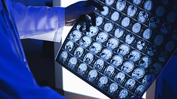 istock MRI of the head 2230980186