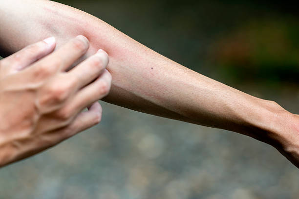 istock People feel itchy skin while practicing exercise in a public park outdoors. Concept of a Healthy active lifestyle 2231034213