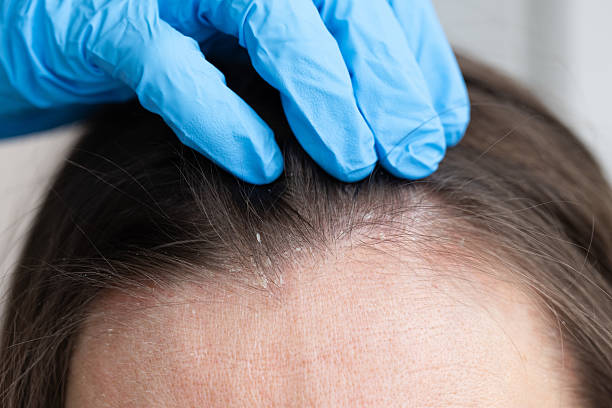 istock An appointment with a trichologist. 2231288182