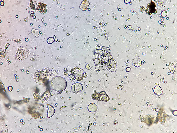 istock Microscopic urinalysis showing uric acid, Calcium oxalate, triple phosphate and also bacteria. 2231398085