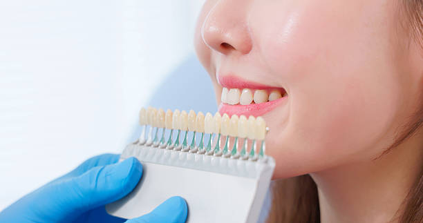 istock dentist use shade comparison choosing teeth color 2231453319
