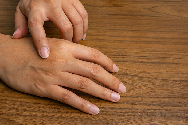 istock Work-related back-of-hand pain, Indicates joint strain, soft tissue stress, or early nerve irritation. 2231759349