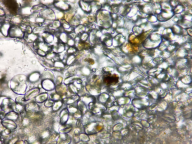 istock Microscopic urinalysis showing uric acid, Calcium oxalate, triple phosphate and also bacteria. 2231761550