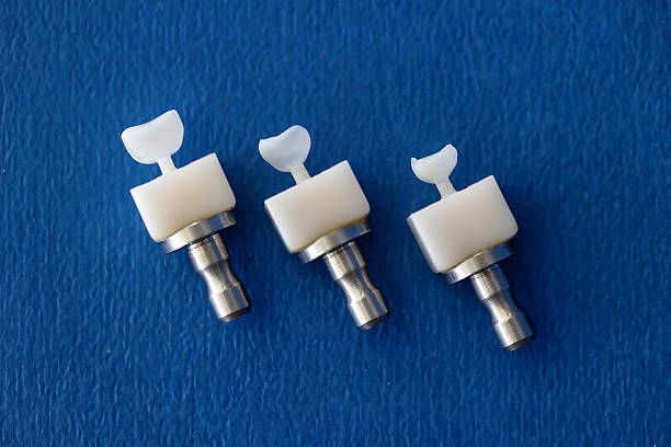Close-up of three ceramic dental veneers attached to CAD/CAM blocks on blue background. Concept of modern digital dentistry, precision milling, and prosthetic fabrication.