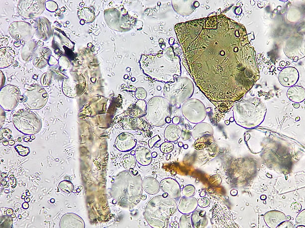istock Microscopic urinalysis showing uric acid, Calcium oxalate, triple phosphate. 2232132221