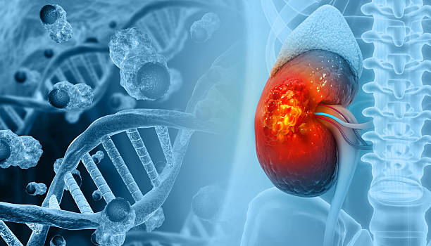 istock Diseased human kidney. kidney cancer. 3d illustration 2232155539