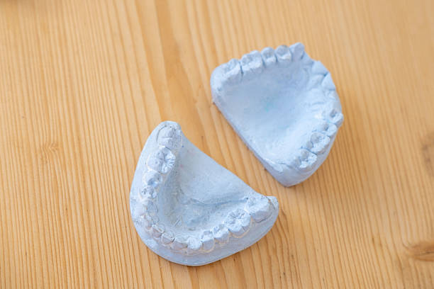 Two light dental plaster casts, Orthodontic models upper and lower jaw, Preparation for braces or dentures, teeth molds, dentistry concept