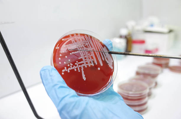 istock A scientist in a lab examining bacteria in a petri dish 2232357727