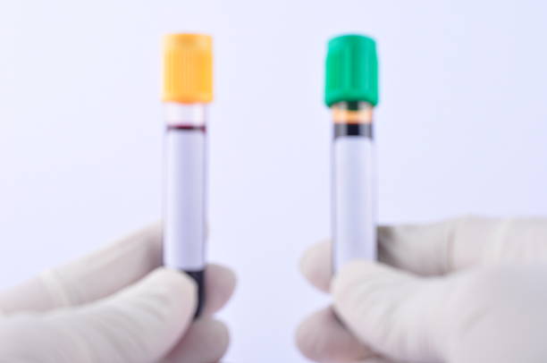 Hand holds a test tube containing a blood sample test. Laboratory testing patient.