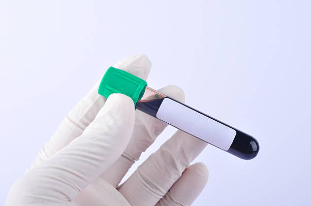 istock Hand holds a test tube containing a blood sample test 2232478189