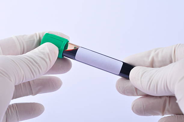 istock Hand holds a test tube containing a blood sample test 2232478203