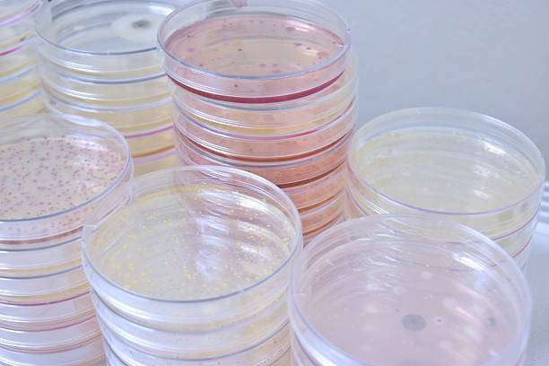 Colonies of bacteria growth on agar plate medium in laboratory.