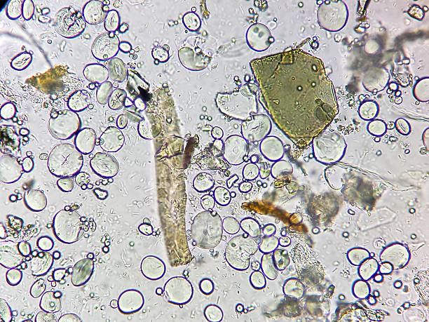 istock Microscopic urinalysis showing uric acid, Calcium oxalate, triple phosphate. 2232663043