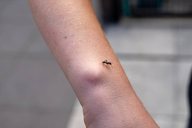Closeup of a Messor Barbarus ant on a wrist of a teenager.