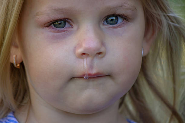 The girl has allergies. Snot