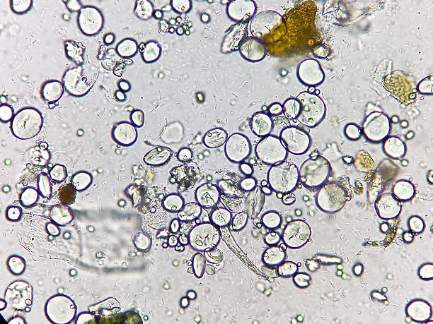 istock Microscopic urinalysis, uric acid, Calcium oxalate, triple phosphate. 2233099846