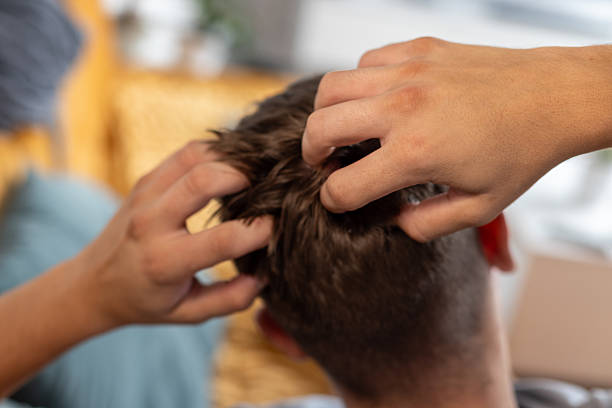 istock Close-Up of Head Massage Showing Hands Applying Relaxation Techniques 2233254542