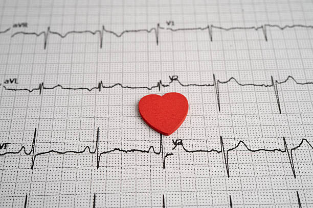 istock Electrocardiogram ECG, heart wave, heart attack, cardiogram report. 2233520235