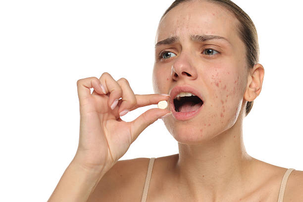 istock Young woman with acne taking a pill, studio shot on white background 2233545894