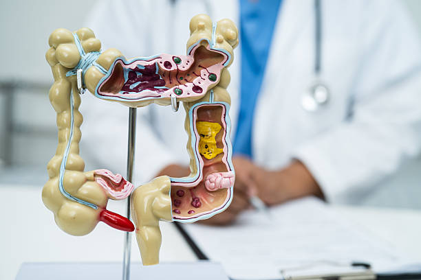 istock Intestine, appendix and digestive system, doctor holding anatomy model for study diagnosis and treatment in hospital. 2233620106