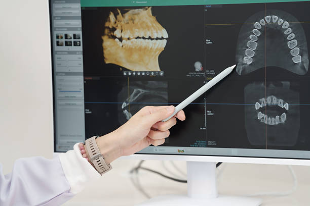 istock Asian female dentist hand pointing with stylus at panoramic dental xray image on computer monitor during oral examination consultation in modern diagnostic clinic room 2233776580