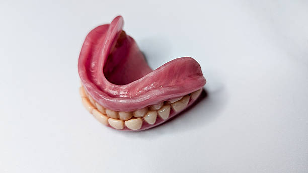 istock Full removable dentures close-up on a white background. Orthopedic dentistry using modern technologies for restoring lost teeth. Dentistry concept. 2233784985
