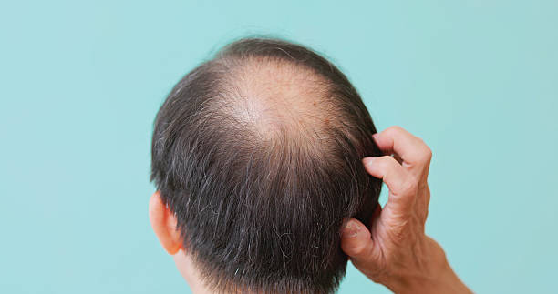 istock elderly man checking receding hairline 2234129661