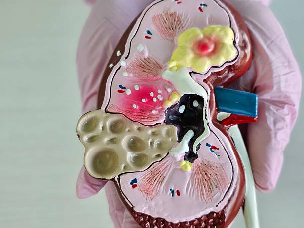 istock Detailed model of a human kidney showcasing internal structures 2234155619