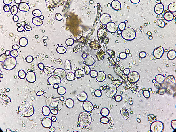 istock Microscopic urinalysis showing uric acid, Calcium oxalate, triple phosphate. 2234221603