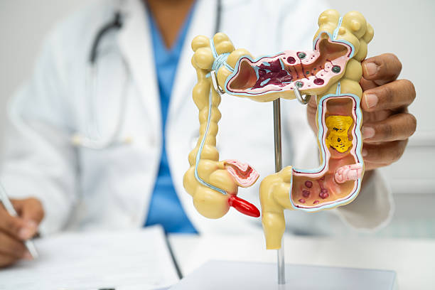 istock Intestine, appendix and digestive system, doctor holding anatomy model for study diagnosis and treatment in hospital. 2234626288