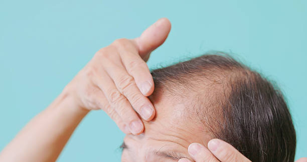 istock elderly man checking receding hairline 2235132000