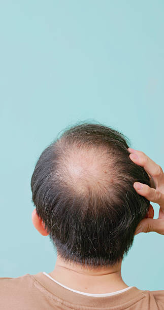 istock elderly man checking receding hairline 2235132075