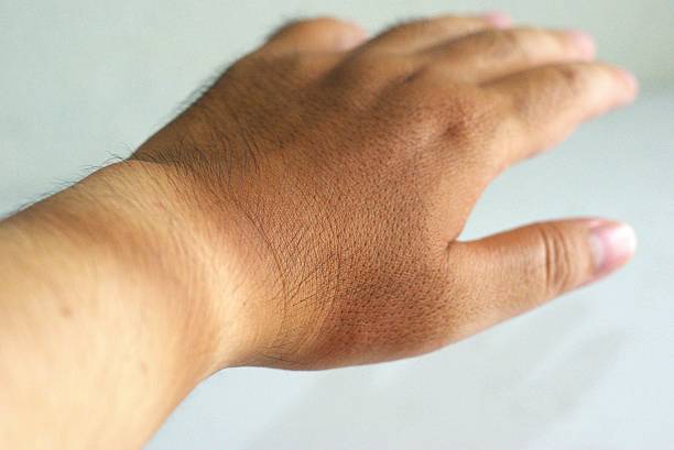 istock Close up of human hand showing visible tan line on wrist 2235166992