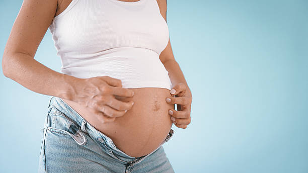 istock Pregnant Woman Scratching Belly in Studio 2235505569