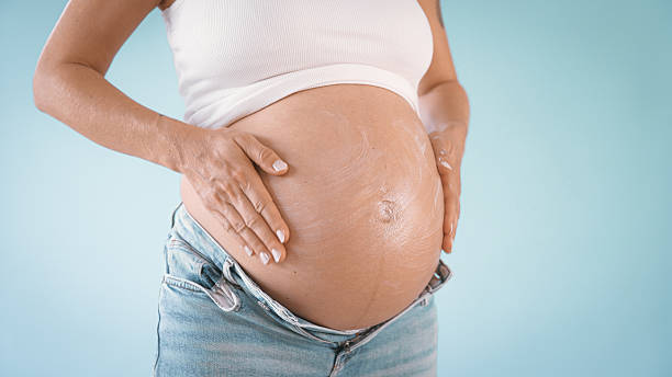 istock Pregnant Woman Applying Lotion on Belly 2235505606