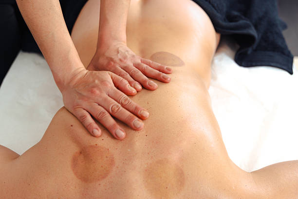istock Hands giving back massage to caucasian person with cupping therapy marks visible 2235532992
