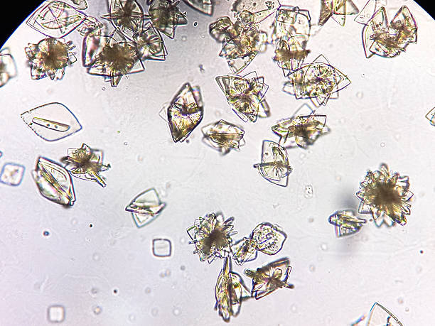 istock Uric acid crystal in urine. Microscopic image. 2235693857
