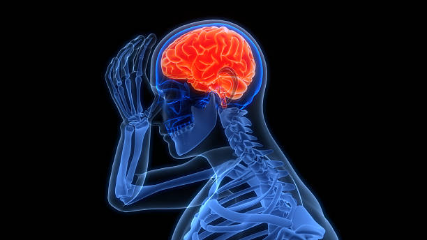 istock Human Suffering with Severe Headache Anatomy 2235749737
